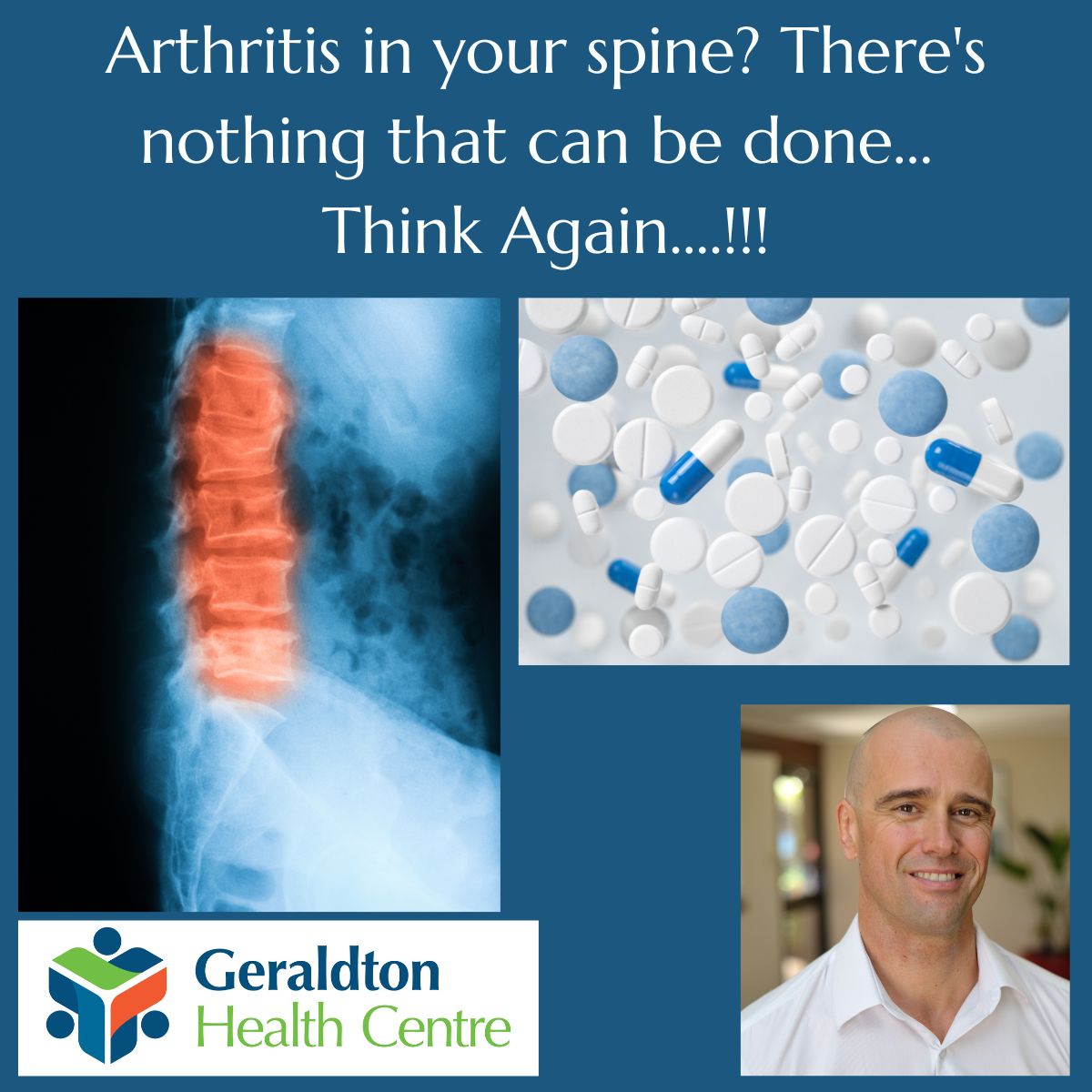 Arthritis in your spine? There's nothing that can be done about